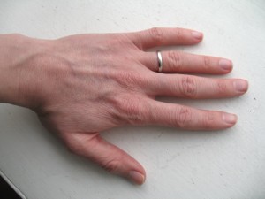 help-for-chapped-winter-hands